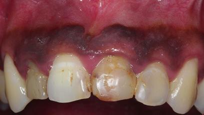 Medicine & Dental Sleep Centre, Perth, WA, Australia) oral pigmentation (Muller 2010).