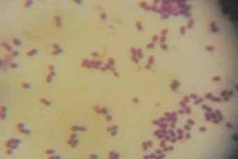 Zone diameter 35 30 25 20 15 10 5 Zone of inhibition (mm) (mm) s (mm) 0 Streptococcus thermophillus 21 0 bulgaricus 21 19 reuteri 30 25 Enterococcus durans 0 21 Fig. (5).