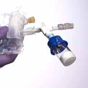 The diluent is transferred from the IV bag to the vial for drug reconstitution. The reconstituted drug is then transferred from the vial back to the bag.