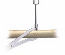 3.5 mm Cortical Screws (Cat. No. 8150-37-0XX) Reduce the fracture and maintain the reduction with bone forceps. Drill a gliding hole in the near cortex with the 3.5 mm Drill Bit (Cat. No. 8290-32-070) using the 2.