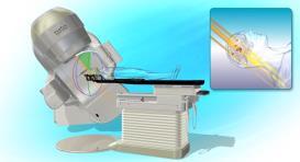 Varian Brachytherapy Product suite for planning and delivery ProBeam Proton therapy systems 5 *