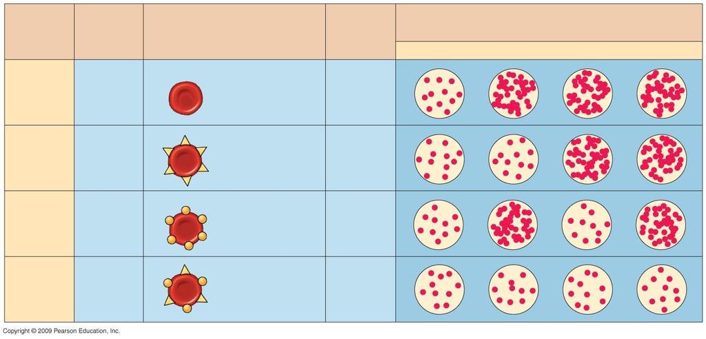 Blood Group (Phenotype) Genotypes Red Blood Cells Antibodies Present in Blood Reaction When Blood from Groups Below Is Mixed with Antibodies