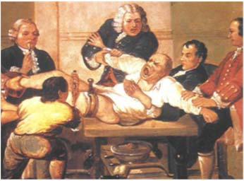 salvage Percival Pott 1756 Surgical Management of Open Fractures Pre-anesthetic Era Lack of time