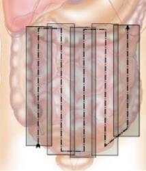 Overview of gut and mesentery Colon Picture Frame (High Frequency
