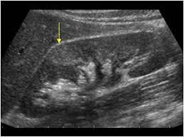 ultrasoundcases.info/slide-view.aspx?