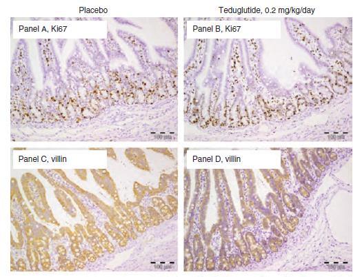 Neonatal Piglet Jejunostomy Model, Teduglutide + PN for 7 days Enhanced