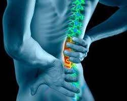 Diagnosis: Strained Lower Back Injury What is Strained Lower Back Injury?