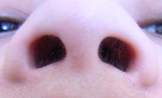 The nose The external opening of the nose is the nostrils or anterior nares.