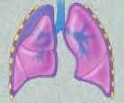 Surgery may be done for other conditions, as well, such as a collapsed lung or fluid around the lung.