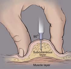 Warren Grant Magnuson Clinical Center National Institutes of Health What is a subcutaneous injection? A subcutaneous injection is given in the fatty layer of tissue just under the skin.