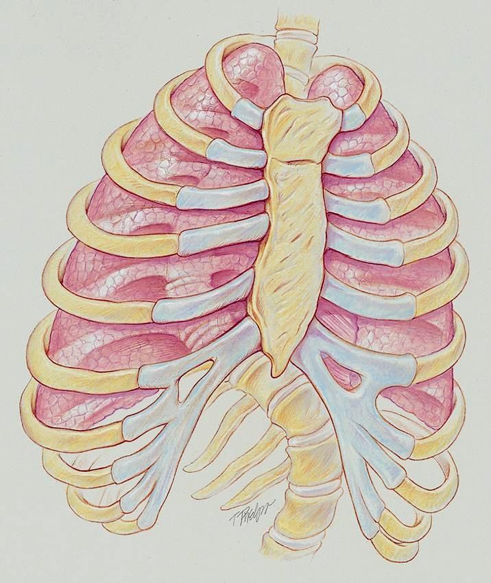 A Figure 24-1. Kyphoscoliosis.