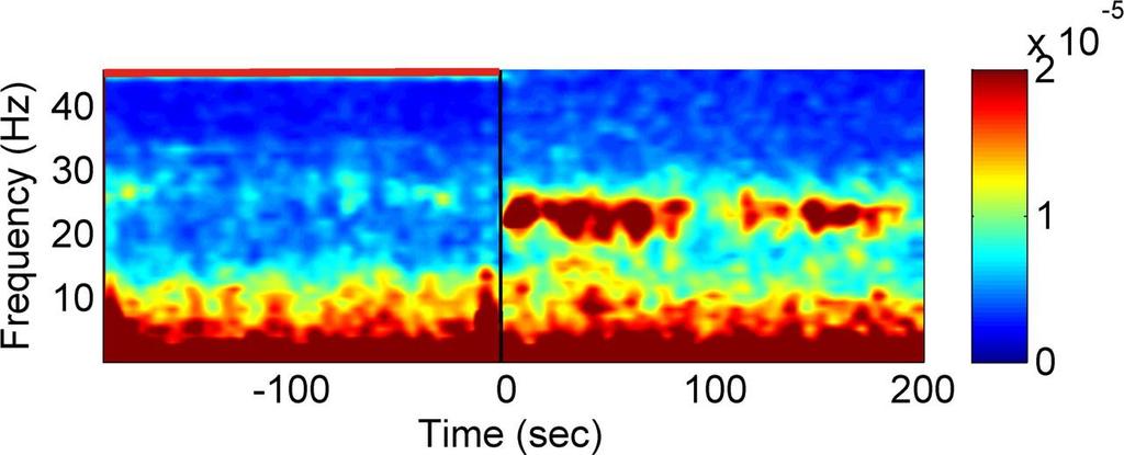 Neural oscillations in Parkinson's DBS ON DBS OFF Oscillatory activity recorded from GPi