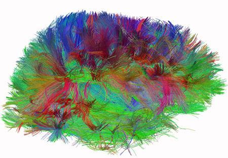 NETWORK EFFECTS White matter fiber architecture of the brain.