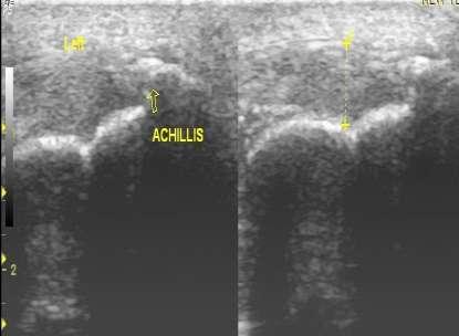 Ultrasound image Figure 3: Left