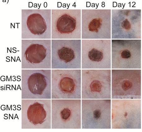 Topical Application of GM3S SNAs Increases the