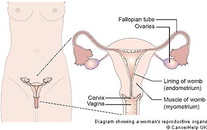 3. What is the risk of developing ovarian and endometrial cancer in your lifetime? Your risk of developing either cancer depends upon your family history.