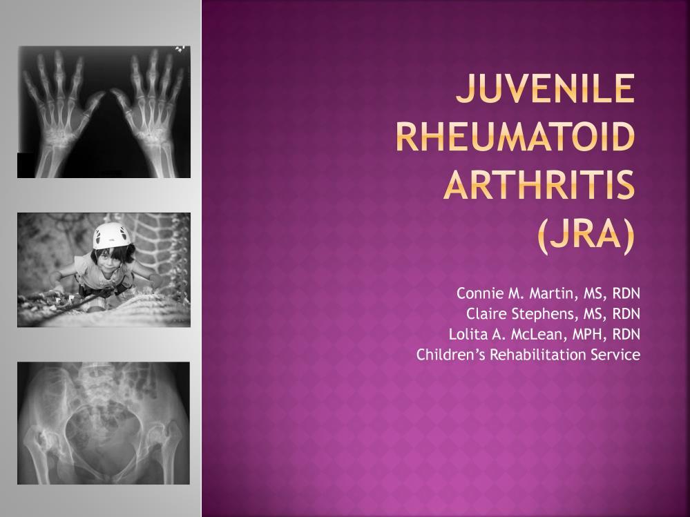 Welcome to Juvenile Rheumatoid Arthritis or JRA, by Connie Martin, MS, RDN; Claire Stephens, MS, RDN; and Lolita McLean, MPH, RDN.