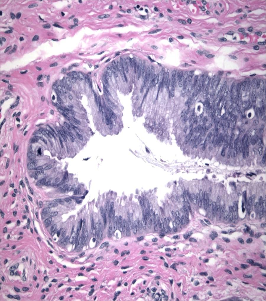 Endocervical Glandular