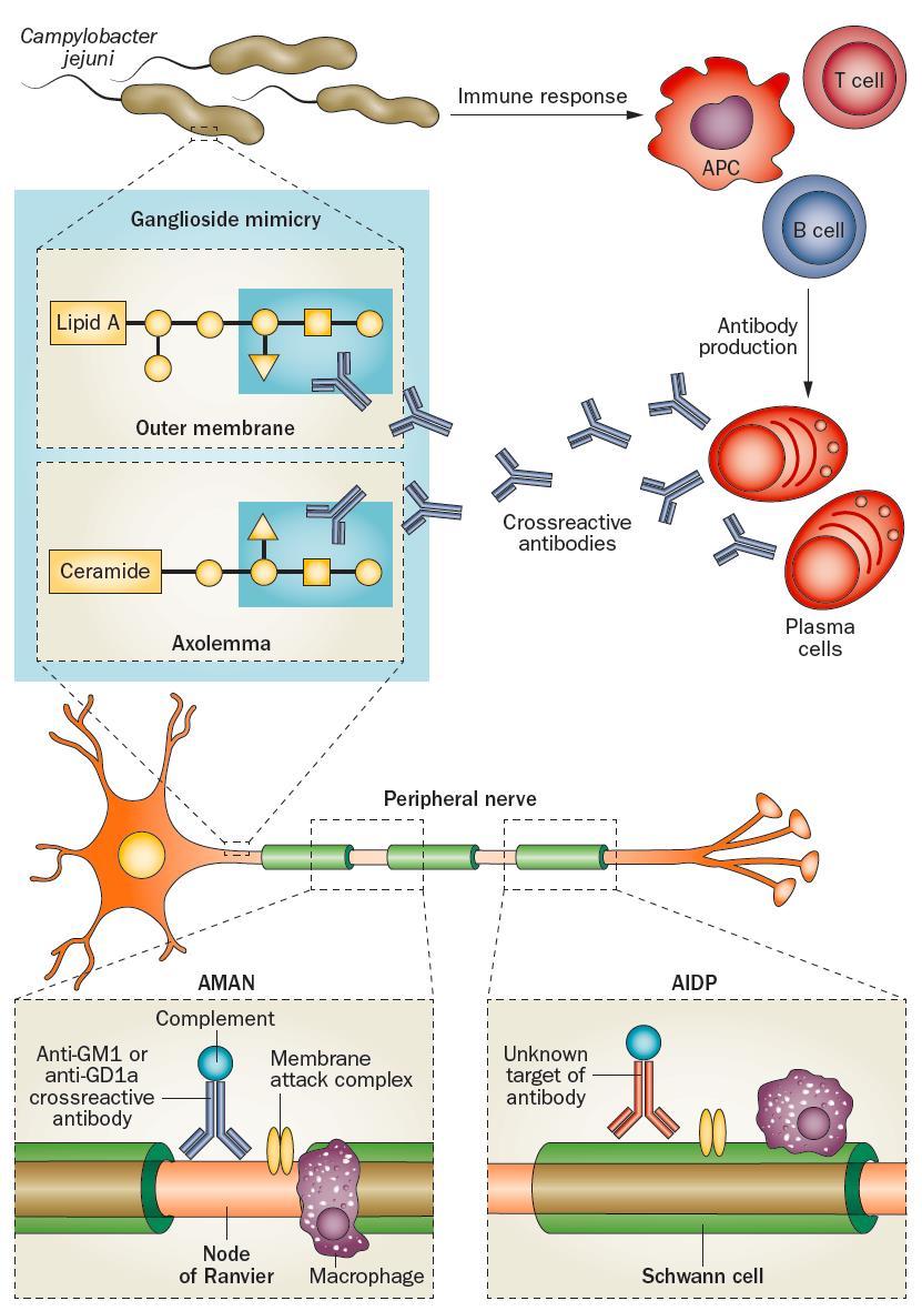 Pathogenesis of GBS The infectious agent triggers an immune response Molecular mimicry induces a crossreaction with Abs towards nerve gangliosides and other unknown targets The complement