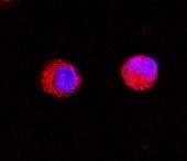 Monocyte 1 BHP1-3SC 2 #