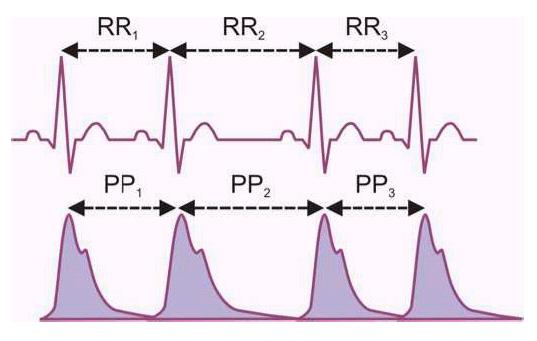 Heart Rate Variability (HRV) ANS Baseline Evaluation Heart rate variability (HRV) The physiological phenomenon of variation in the time interval between heartbeats.