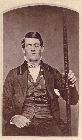 Phineas Gage First indication can