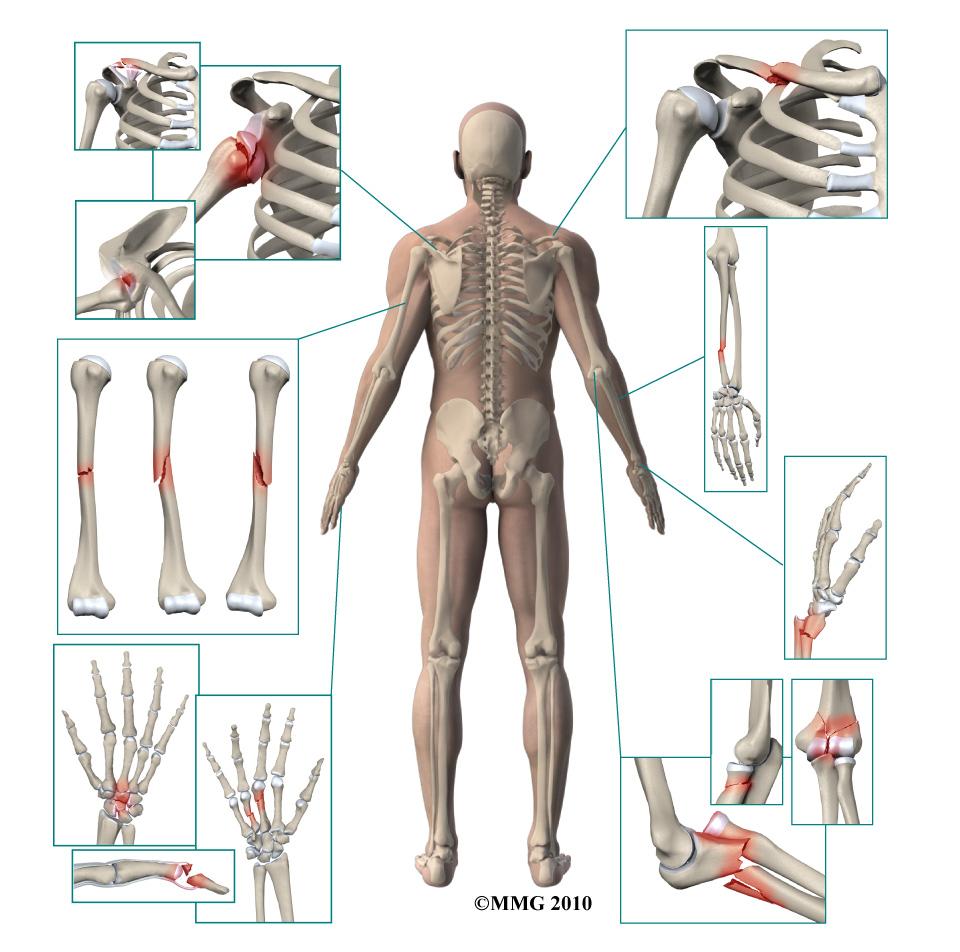 A Patient s Guide to Adult Distal Radius