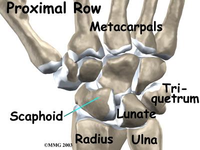 Anatomy A Patient's Guide to Adult Distal Radius (Wrist) Fractures Adult Distal Radius (Wrist) Fractures The distal radius is part of the radius, one of the two bones in the forearm.