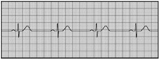 The width of a single small square on ECG paper represents 0.