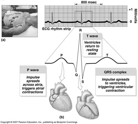 Electrocardiogram (ECG or EKG) Record of electrical events in the heart 10 11 Control of Cardiac Output Control of Cardiac Output Blood Volume Reflexes