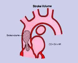 Stroke Volume (SV) Volume of blood pumped out by each