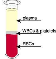 Blood Blood consists of red and white blood cells, platelets and plasma Plasma is a watery yellow liquid
