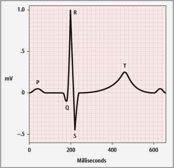 Electrocardiogram In an ECG(electrocardiogram) test, the electrical impulses made while the heart is beating are recorded and shown on a piece of paper