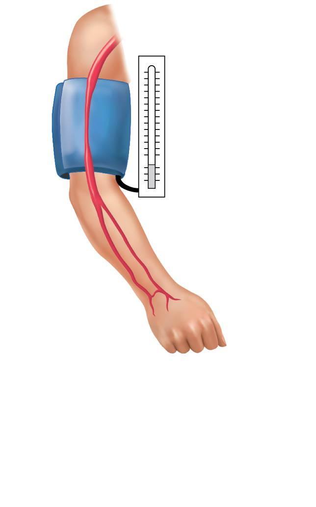 Figure 11.21d Measuring blood pressure. Pressure in cuff below 70; no sounds audible 70 mm Hg 2015 Pearson Education, Inc.