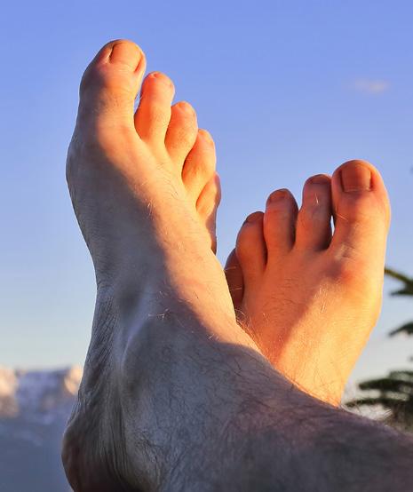 Why the Big Toe? Half of first-time acute flares strike the big toe. Ninety percent of patients will suffer gout of the big toe at some point during the course of the disease.