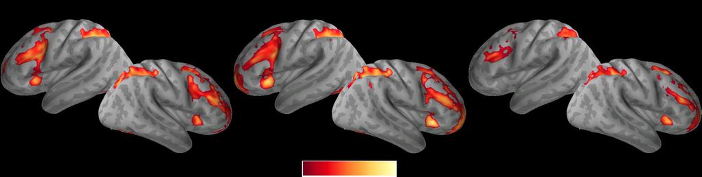 WM-Intact & WM-Impaired ADHD Groups Increased activation with increased WM load in fronto-parietal WM network 3-back