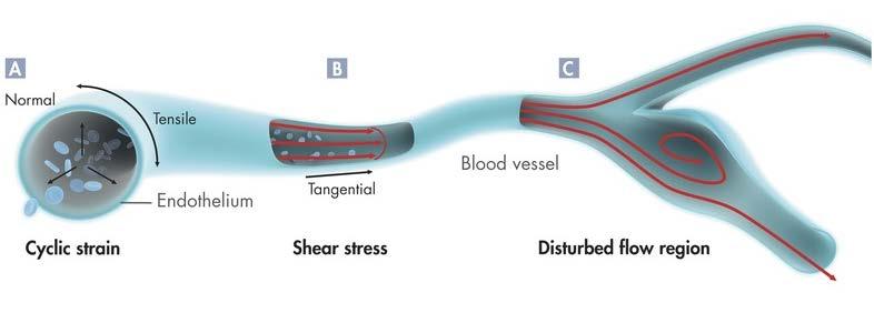 Endothelial Cells sense strain and fluidic shear stress High laminar steady or pulsatile flow keeps EC passivated, while low or disturbed flow is