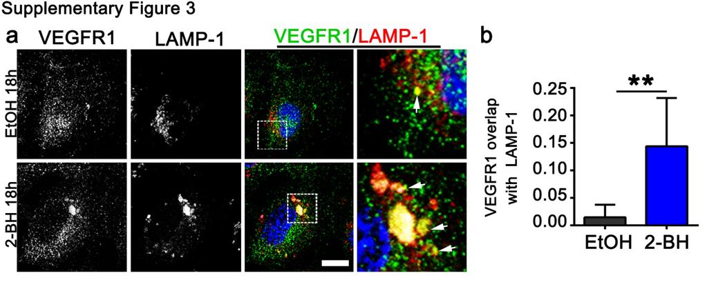 Supplementary Figure 3 (linked to Figure 3). Palmitoylation regulates mvegfr1 localization with lysosomes.