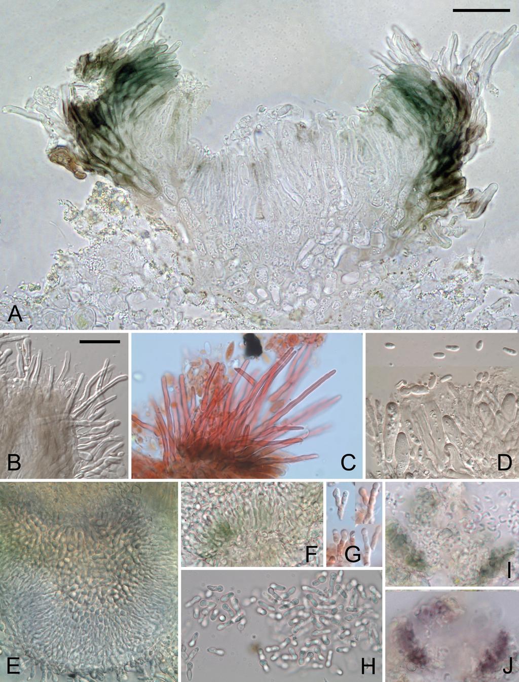 Fig. 3. A H, Diplolaeviopsis symmictae (holotype, except C: Coppins 24107). A, Section through ascoma in water, showing olivaceous excipular pigment. B, Excipular hairs (DIC).
