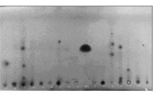 ARCHANA SAWANE 81 Figure 1: Photograph of the TLC plate along with mycotoxins. Large spot in the centre lane is the Griseofulvin, an external standard.