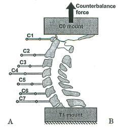 Determination for Physiological range of cervical vertebral motion on IV-NIC 1.Preparation of IV-NIC calculation Flexion 1. Sample of C1-T1 including Occiput without soft tissues Extension 2.