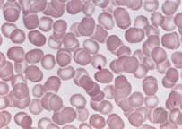 The 4 major components of blood Red Blood Cells: Carry oxygen (energy) White Blood Cells: Immune