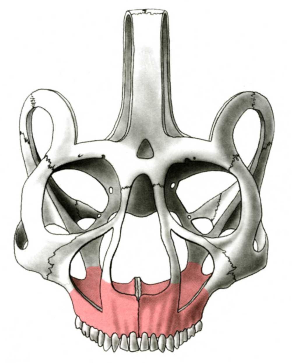Vertical buttress nasomaxillary zygomaticomaxillary pterygomaxillary Tuber maxillae Sinus maxillae