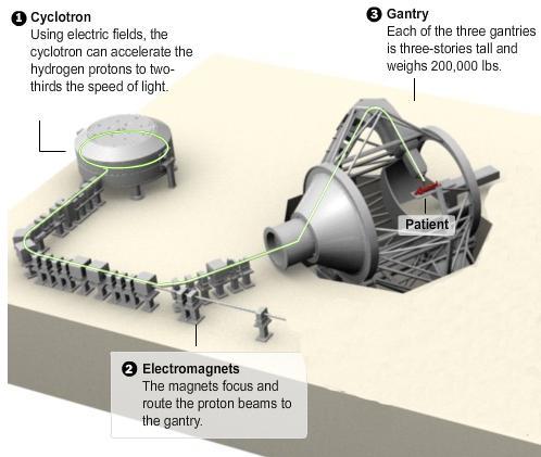 Targeted Radiation (Proton Therapy) Protons are
