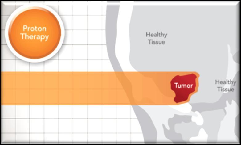 energy beam which is directed at the tumor.