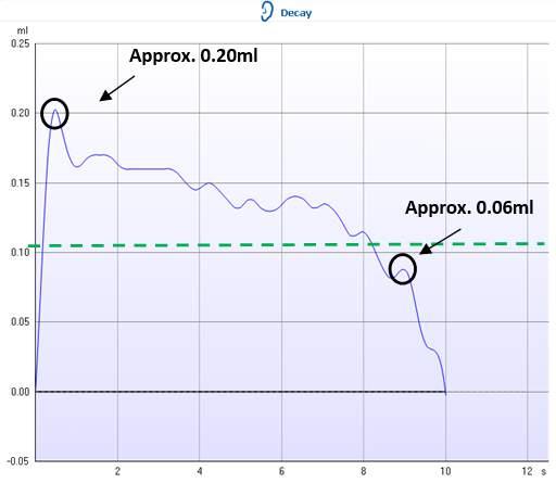 In this example, the reflex decay test is negative as the response did not decay by more than 50% (drop below green dotted line), during the 10 second test interval.