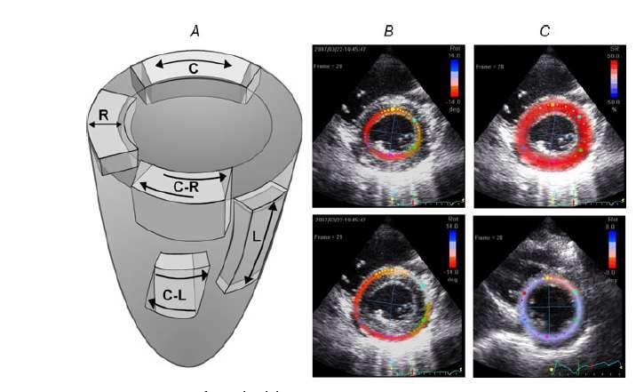 DYNAMIC EXERCISE AND CARDIAC CHAMBERS