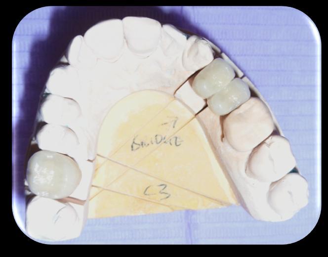 visualised on the periapical radiograph.