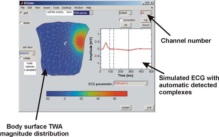 Simulation of T-Wave Alternans and its Relation to the Duration The Open Pacing, Electrophysiology & Therapy Journal, 2010, Volume 3 23 Fig. (2).