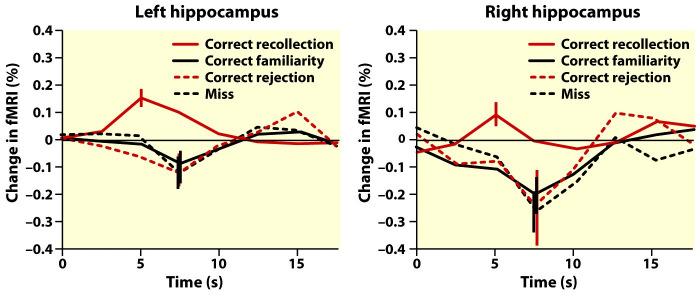 recollection (recognize + source) increased hemodynamic activity Recollection,